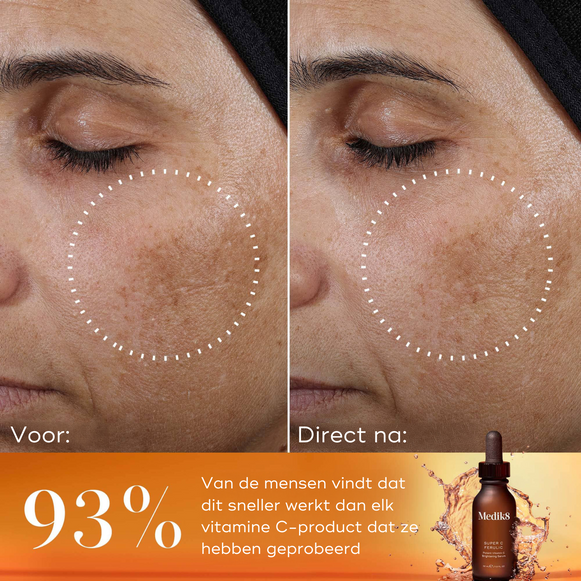vitamine-c-serum-gezichtsserum