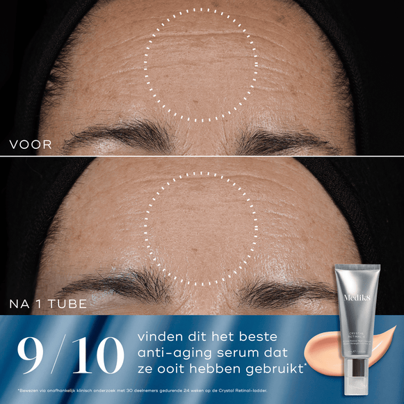 Rejuvenation Reset-hover-71