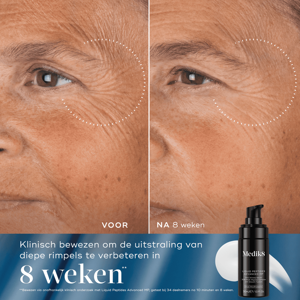 Rejuvenation Reset