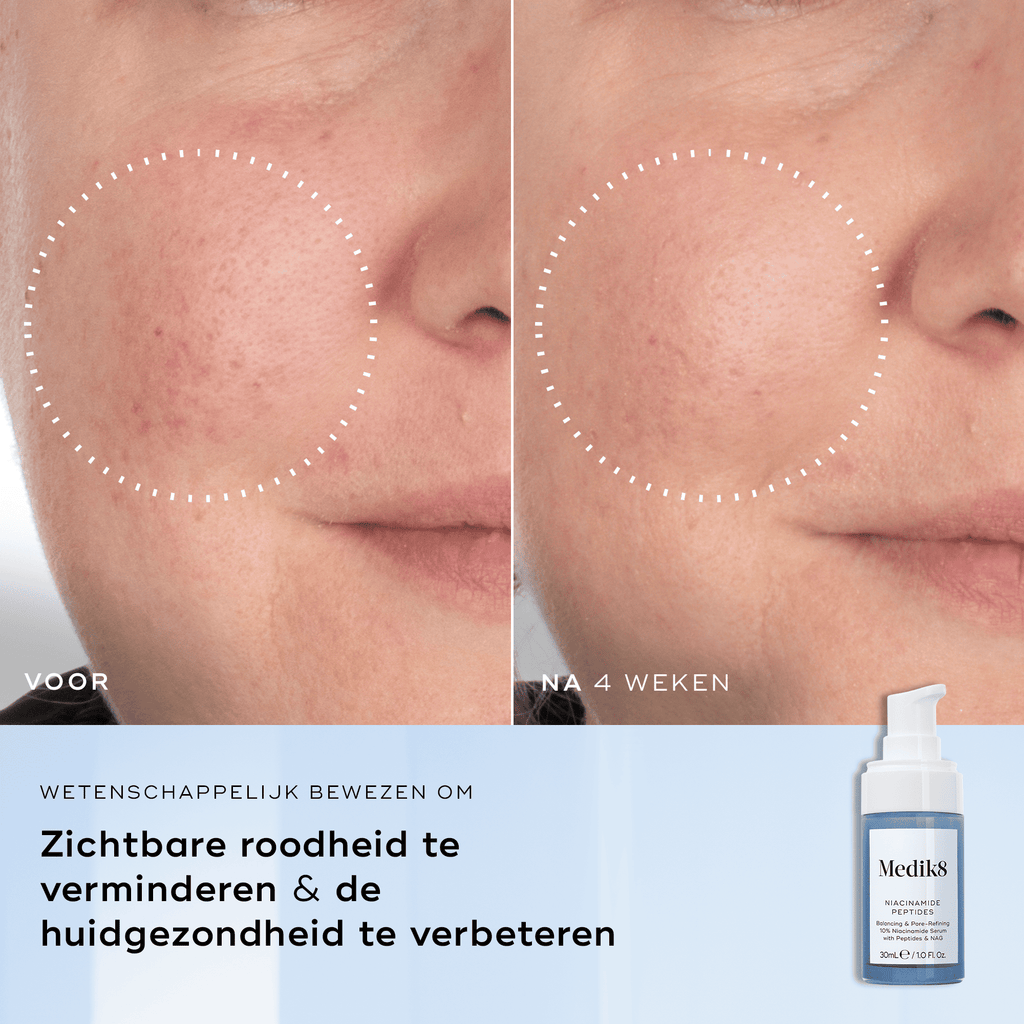 Niacinamide Peptides